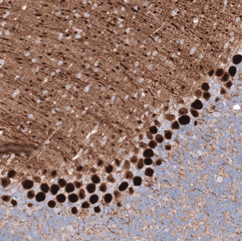 Calbindin D-28K Antibody (CL15059) - Azide and BSA Free Immunohistochemistry-Paraffin: Calbindin D-28K Antibody [NBP3-44160]