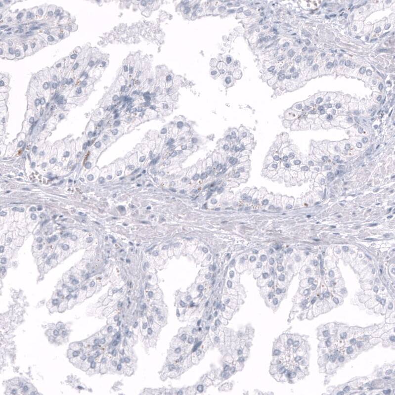 Inhibin beta A Antibody (CL15357) - Azide and BSA Free Immunohistochemistry-Paraffin: Inhibin beta A Antibody [NBP3-44161]