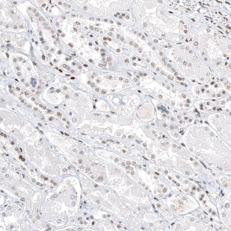 Transcription factor E3 Antibody (CL12822) - Azide and BSA Free Immunohistochemistry-Paraffin: Transcription factor E3 Antibody [NBP3-44162]