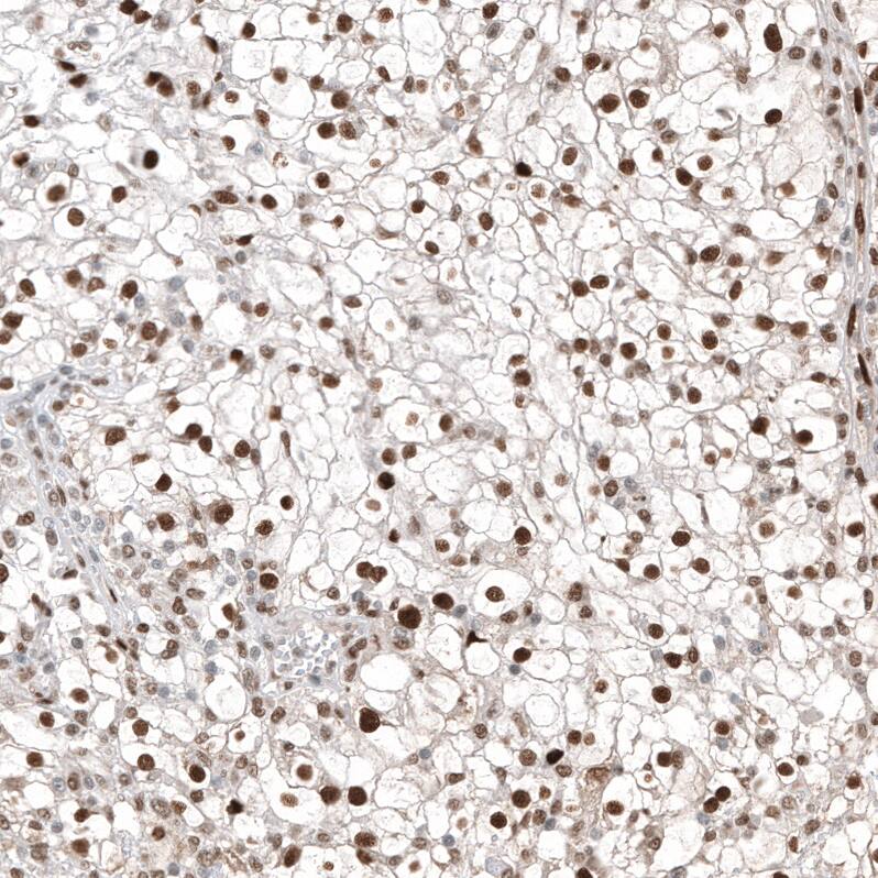 Transcription factor E3 Antibody (CL12822) - Azide and BSA Free Immunohistochemistry-Paraffin: Transcription factor E3 Antibody [NBP3-44162]