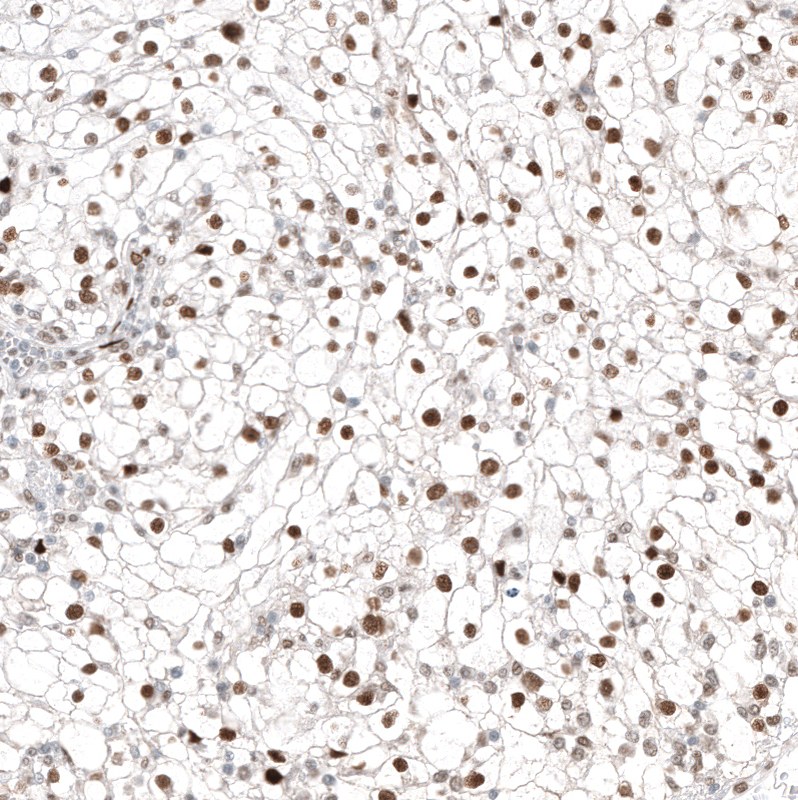 Transcription factor E3 Antibody (CL12810) - Azide and BSA Free Immunohistochemistry-Paraffin: Transcription factor E3 Antibody [NBP3-44163]