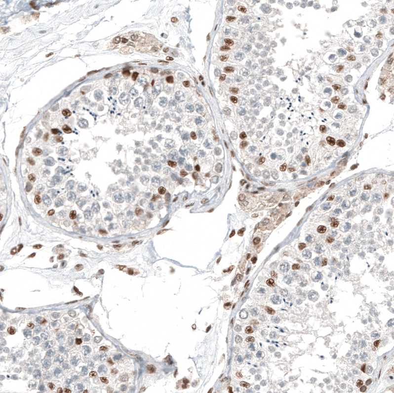 Transcription factor E3 Antibody (CL12810) - Azide and BSA Free Immunohistochemistry-Paraffin: Transcription factor E3 Antibody [NBP3-44163]