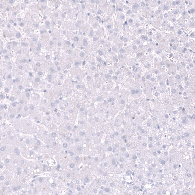 Parvalbumin Antibody (CL15070) - Azide and BSA Free Immunohistochemistry-Paraffin: Parvalbumin Antibody [NBP3-44164]