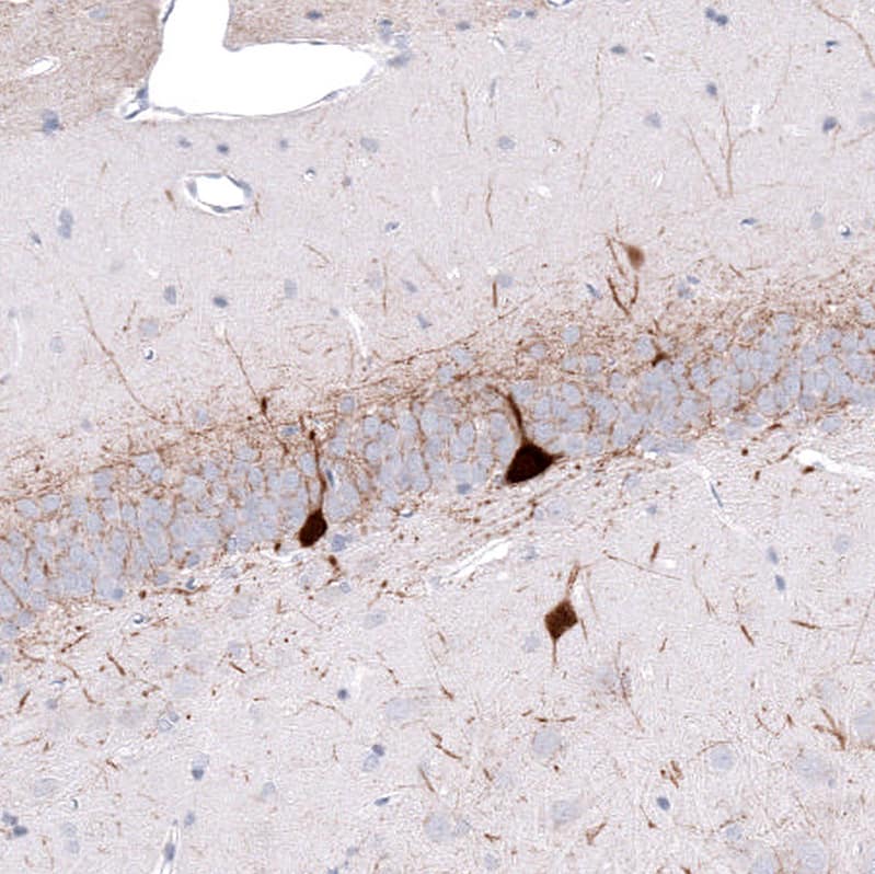 Parvalbumin Antibody (CL15070) - Azide and BSA Free Immunohistochemistry-Paraffin: Parvalbumin Antibody [NBP3-44164]