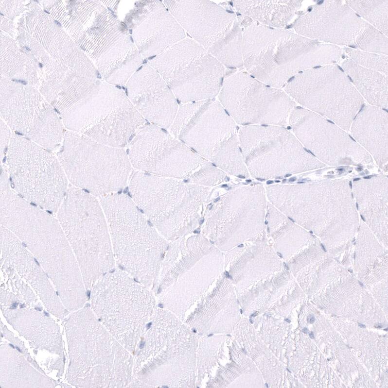 Parvalbumin Antibody (CL15072) - Azide and BSA Free Immunohistochemistry-Paraffin: Parvalbumin Antibody [NBP3-44165]
