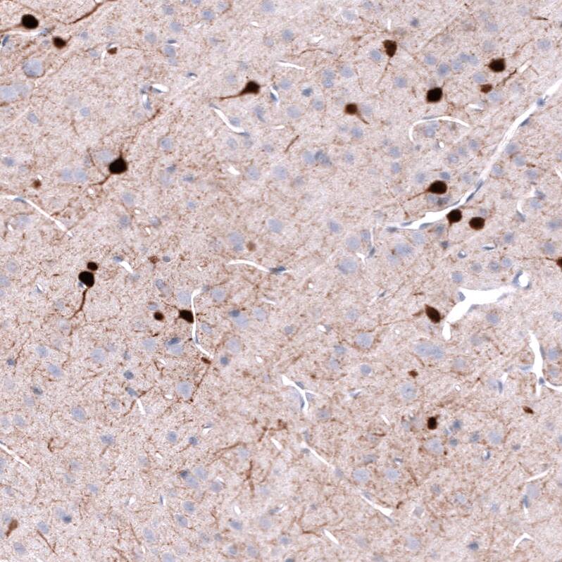 Parvalbumin Antibody (CL15073) - Azide and BSA Free Immunohistochemistry-Paraffin: Parvalbumin Antibody [NBP3-44166]