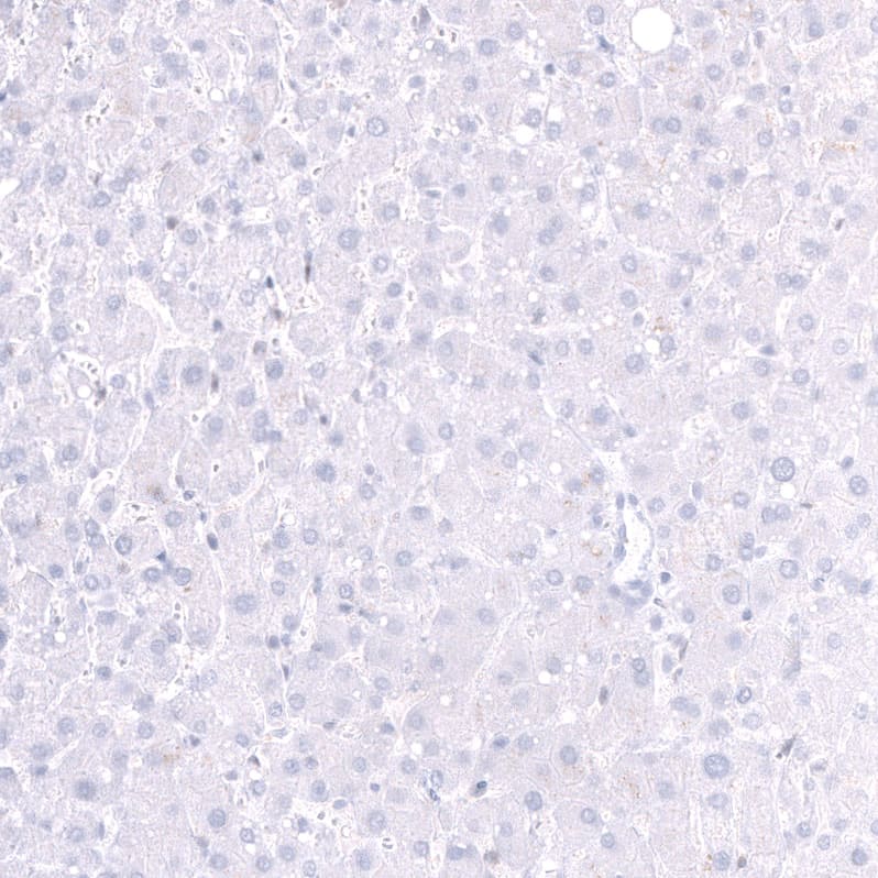 Parvalbumin Antibody (CL15073) - Azide and BSA Free Immunohistochemistry-Paraffin: Parvalbumin Antibody [NBP3-44166]
