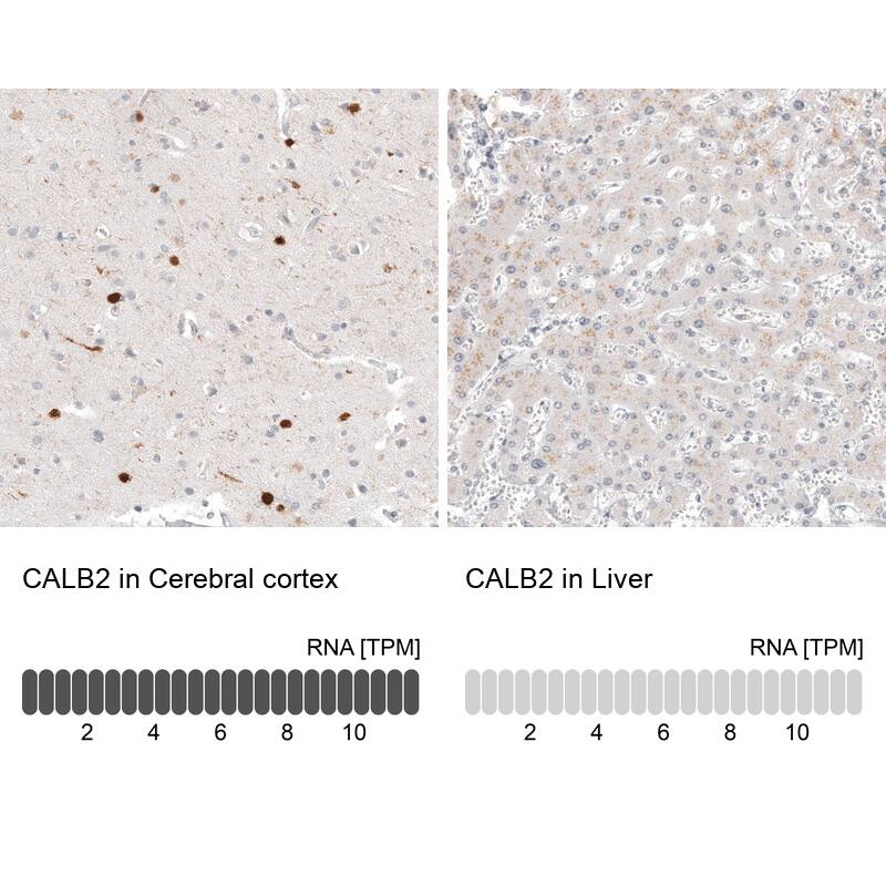 Calretinin Antibody (CL12842) - Azide and BSA Free Immunohistochemistry-Paraffin: Calretinin Antibody [NBP3-44167]