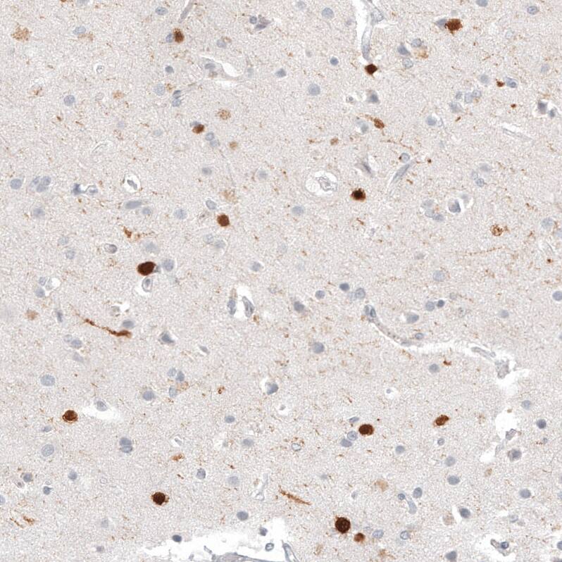 Calretinin Antibody (CL12842) - Azide and BSA Free Immunohistochemistry-Paraffin: Calretinin Antibody [NBP3-44167]