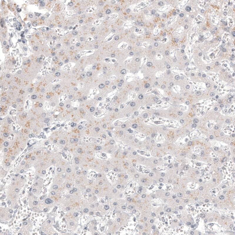 Calretinin Antibody (CL12842) - Azide and BSA Free Immunohistochemistry-Paraffin: Calretinin Antibody [NBP3-44167]