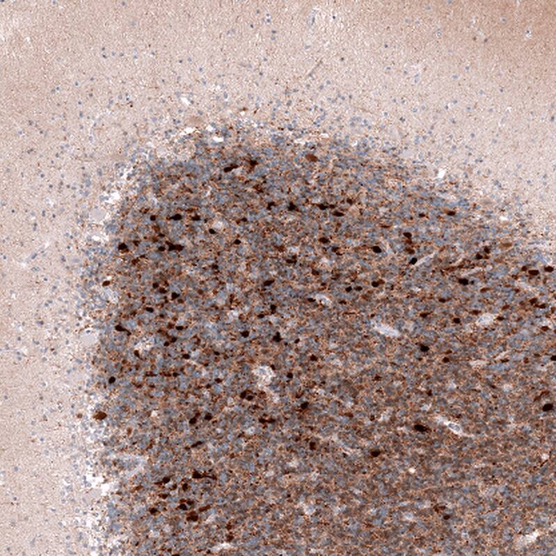 Calretinin Antibody (CL12842) - Azide and BSA Free Immunohistochemistry-Paraffin: Calretinin Antibody [NBP3-44167]