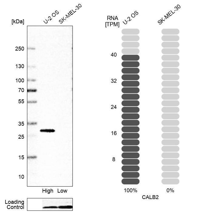 Calretinin Antibody (CL12842) - Azide and BSA Free Western Blot: Calretinin Antibody [NBP3-44167]