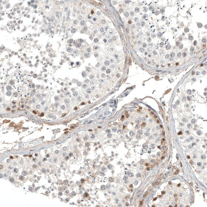 Calretinin Antibody (CL12842) - Azide and BSA Free Immunohistochemistry-Paraffin: Calretinin Antibody [NBP3-44167]
