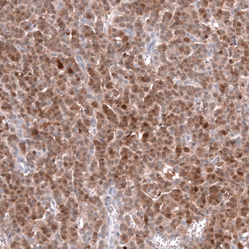 Calretinin Antibody (CL12842) - Azide and BSA Free Immunohistochemistry-Paraffin: Calretinin Antibody [NBP3-44167]