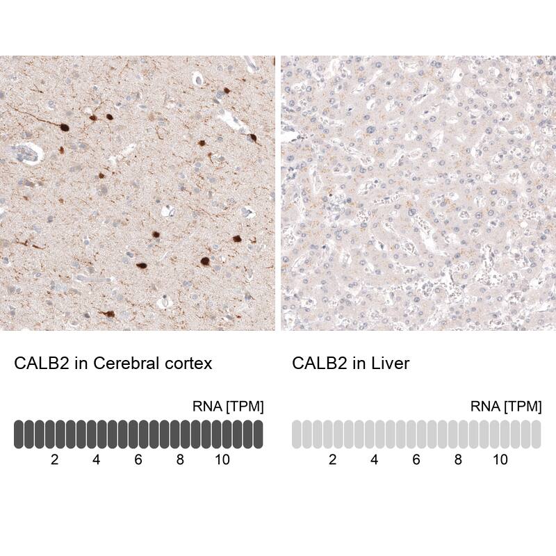 Calretinin Antibody (CL12838) - Azide and BSA Free Immunohistochemistry-Paraffin: Calretinin Antibody [NBP3-44168]