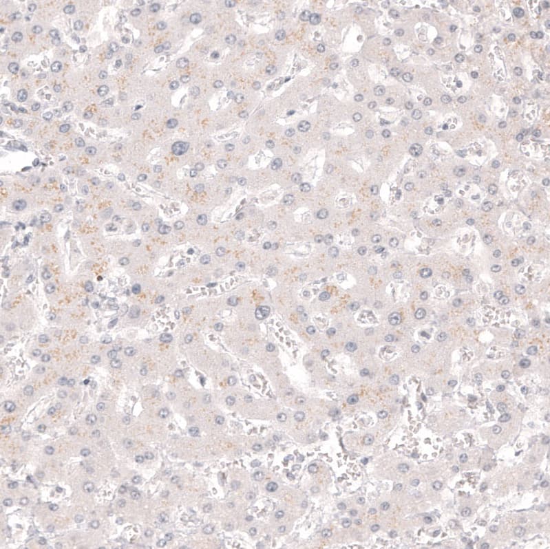 Calretinin Antibody (CL12838) - Azide and BSA Free Immunohistochemistry-Paraffin: Calretinin Antibody [NBP3-44168]