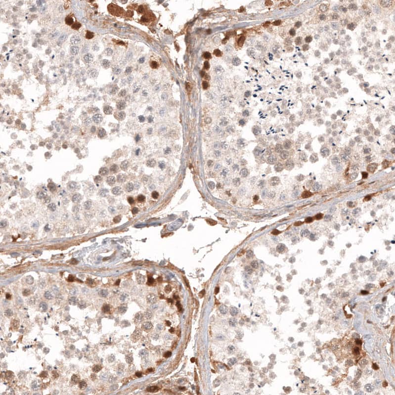 Calretinin Antibody (CL12838) - Azide and BSA Free Immunohistochemistry-Paraffin: Calretinin Antibody [NBP3-44168]
