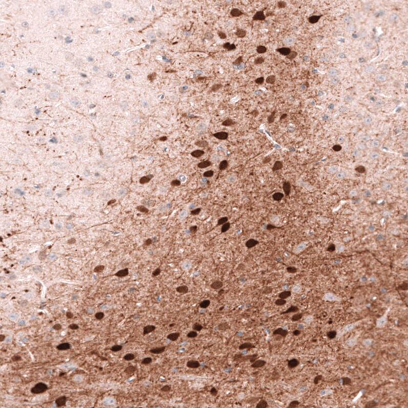 Calretinin Antibody (CL12838) - Azide and BSA Free Immunohistochemistry-Paraffin: Calretinin Antibody [NBP3-44168]