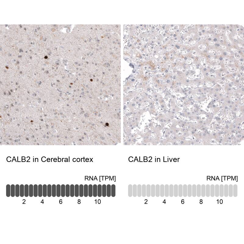 Calretinin Antibody (CL12836) - Azide and BSA Free Immunohistochemistry-Paraffin: Calretinin Antibody [NBP3-44169]