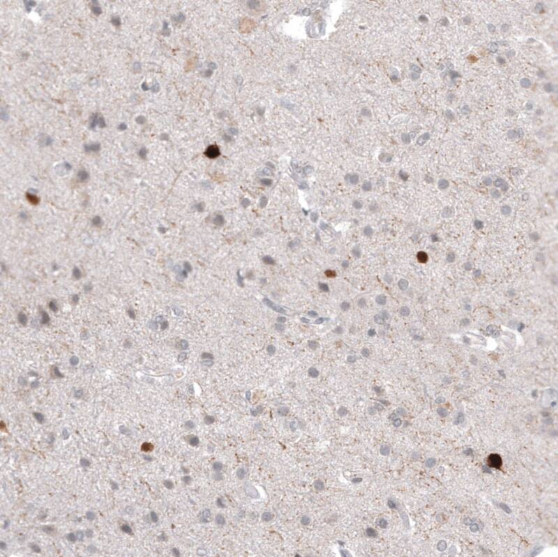 Calretinin Antibody (CL12836) - Azide and BSA Free Immunohistochemistry-Paraffin: Calretinin Antibody [NBP3-44169]