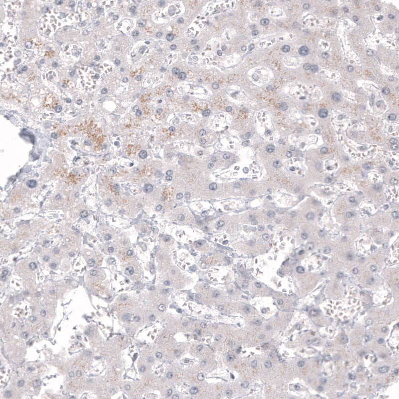 Calretinin Antibody (CL12836) - Azide and BSA Free Immunohistochemistry-Paraffin: Calretinin Antibody [NBP3-44169]