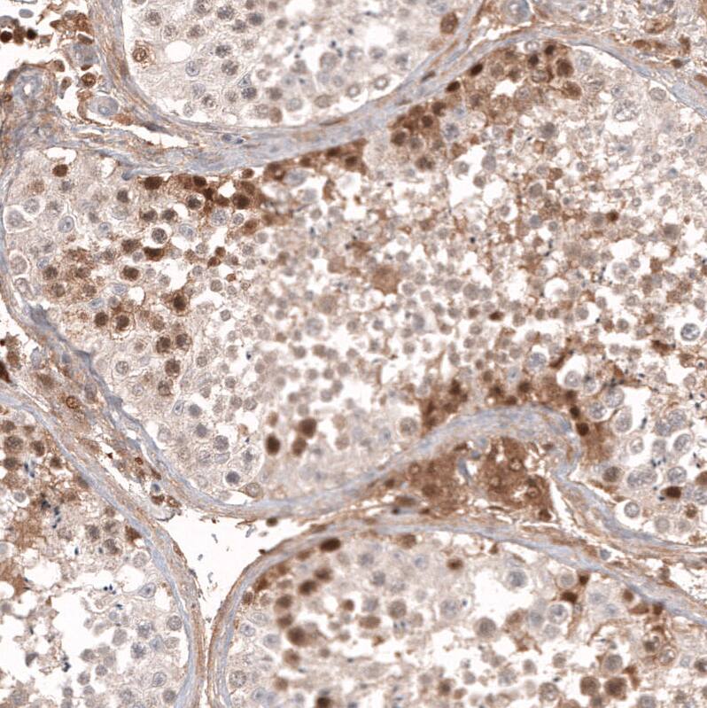Calretinin Antibody (CL12836) - Azide and BSA Free Immunohistochemistry-Paraffin: Calretinin Antibody [NBP3-44169]