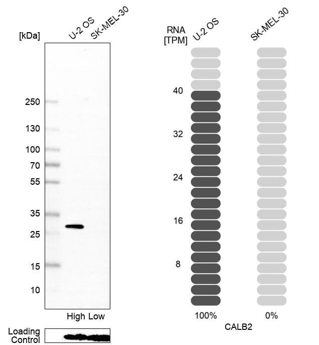 Calretinin Antibody (CL12836) - Azide and BSA Free Western Blot: Calretinin Antibody [NBP3-44169]