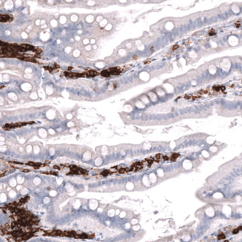 CD38 Antibody (CL15572) - Azide and BSA Free Immunohistochemistry-Paraffin: CD38 Antibody [NBP3-44170]