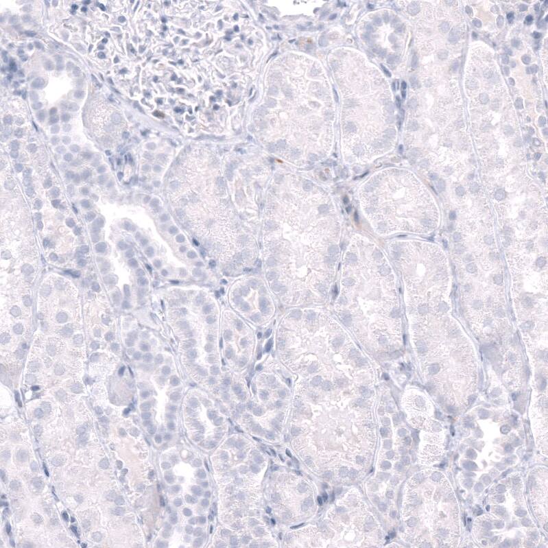 CD38 Antibody (CL15572) - Azide and BSA Free Immunohistochemistry-Paraffin: CD38 Antibody [NBP3-44170]