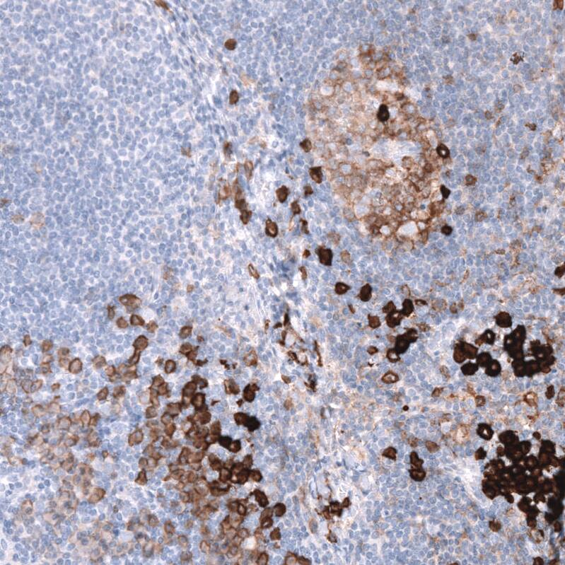 CD38 Antibody (CL15572) - Azide and BSA Free Immunohistochemistry-Paraffin: CD38 Antibody [NBP3-44170]