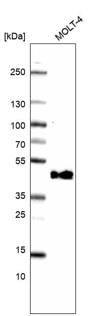 CD38 Antibody (CL15572) - Azide and BSA Free Western Blot: CD38 Antibody [NBP3-44170]