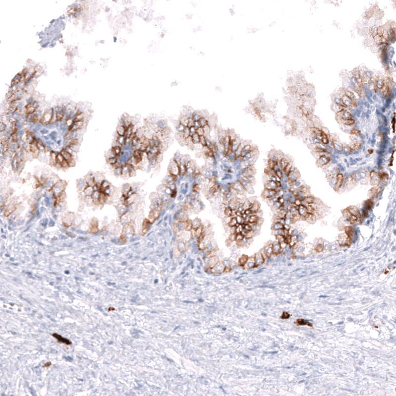 CD38 Antibody (CL15572) - Azide and BSA Free Immunohistochemistry-Paraffin: CD38 Antibody [NBP3-44170]