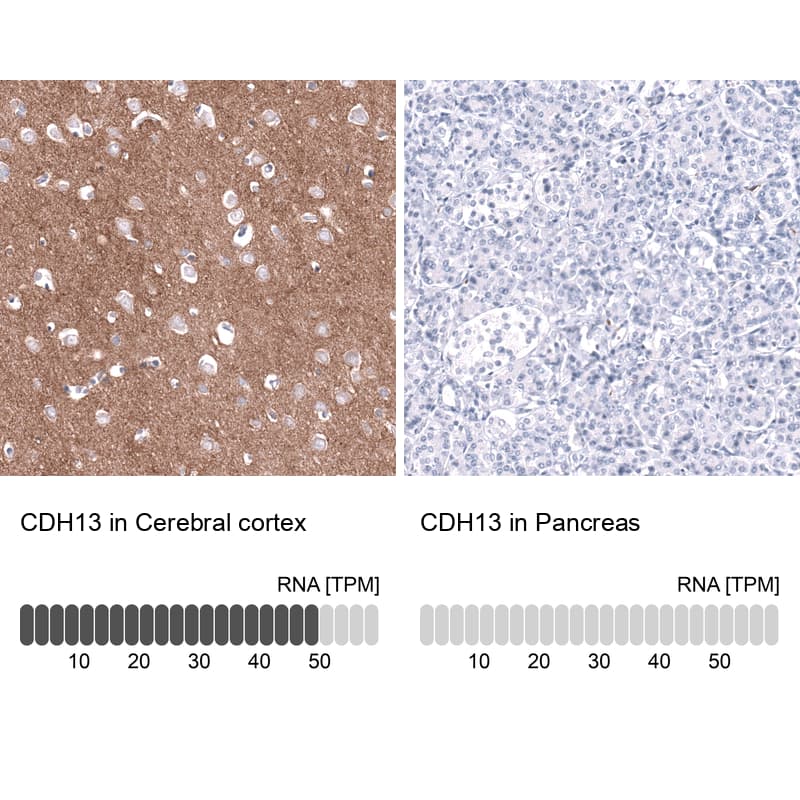 Cadherin-13 Antibody (CL15368) - Azide and BSA Free Immunohistochemistry-Paraffin: Cadherin-13 Antibody [NBP3-44172]