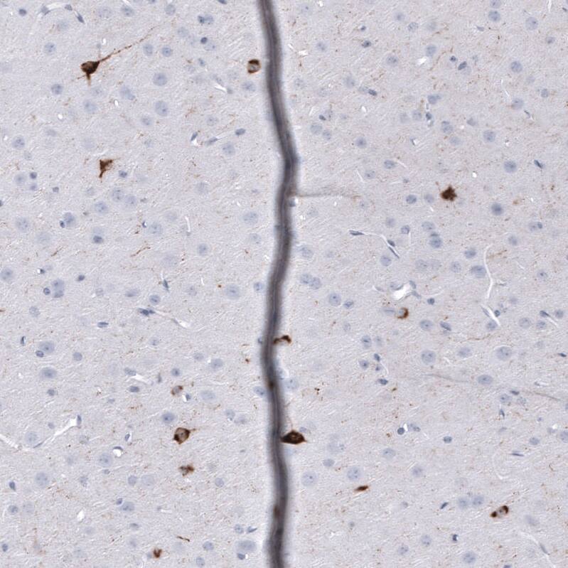 Somatostatin Antibody (CL15076) - Azide and BSA Free Immunohistochemistry-Paraffin: Somatostatin Antibody [NBP3-44173]