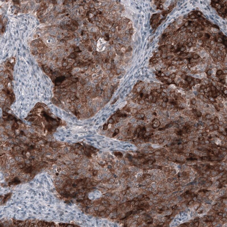 HE4/WFDC2 Antibody (CL12917) - Azide and BSA Free Immunohistochemistry-Paraffin: HE4/WFDC2 Antibody [NBP3-44175]