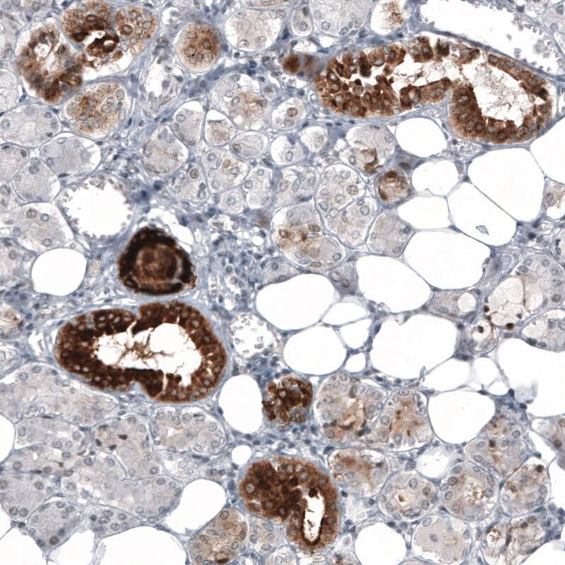 HE4/WFDC2 Antibody (CL12917) - Azide and BSA Free Immunohistochemistry-Paraffin: HE4/WFDC2 Antibody [NBP3-44175]
