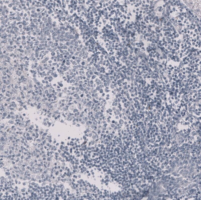 HE4/WFDC2 Antibody (CL12917) - Azide and BSA Free Immunohistochemistry-Paraffin: HE4/WFDC2 Antibody [NBP3-44175]