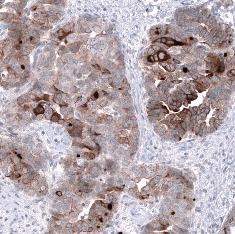 HE4/WFDC2 Antibody (CL12917) - Azide and BSA Free Immunohistochemistry-Paraffin: HE4/WFDC2 Antibody [NBP3-44175]