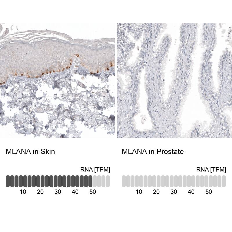 Melan-A/MART-1 Antibody (CL12874) - Azide and BSA Free Immunohistochemistry-Paraffin: Melan-A/MART-1 Antibody [NBP3-44176]