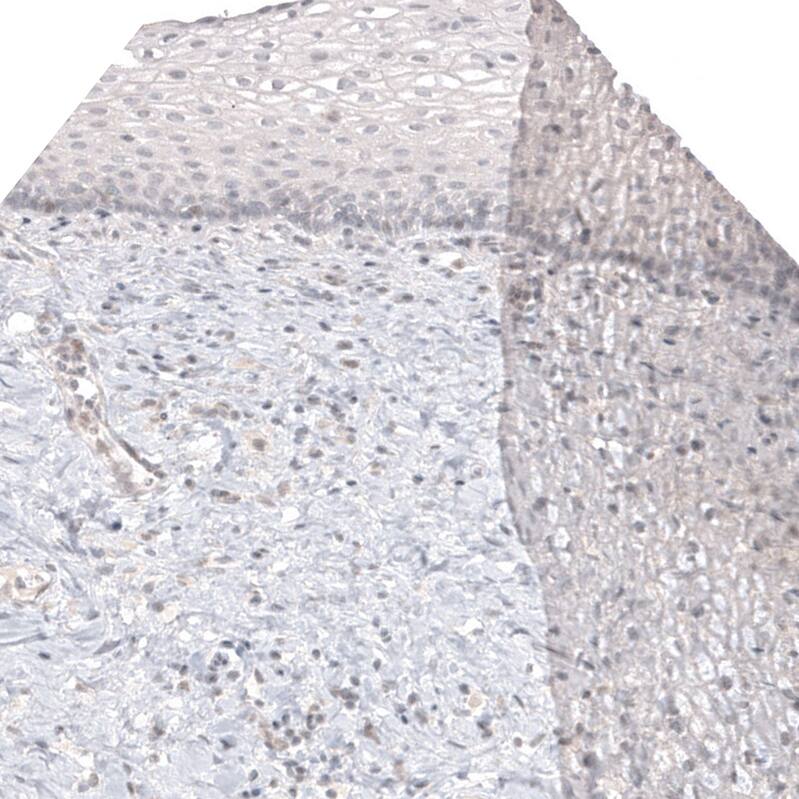 Melan-A/MART-1 Antibody (CL12874) - Azide and BSA Free Immunohistochemistry-Paraffin: Melan-A/MART-1 Antibody [NBP3-44176]