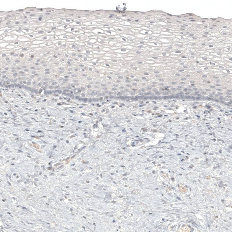 Melan-A/MART-1 Antibody (CL12863) - Azide and BSA Free Immunohistochemistry-Paraffin: Melan-A/MART-1 Antibody [NBP3-44177]