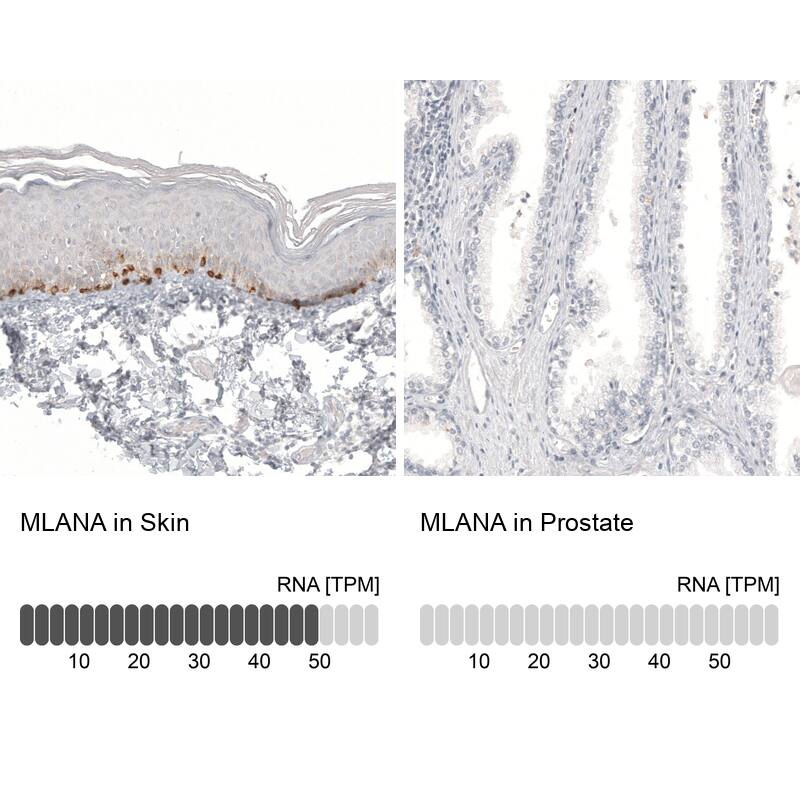 Melan-A/MART-1 Antibody (CL12863) - Azide and BSA Free Immunohistochemistry-Paraffin: Melan-A/MART-1 Antibody [NBP3-44177]