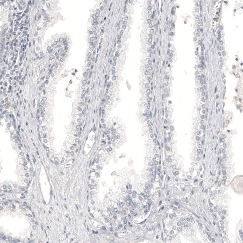 Melan-A/MART-1 Antibody (CL12863) - Azide and BSA Free Immunohistochemistry-Paraffin: Melan-A/MART-1 Antibody [NBP3-44177]
