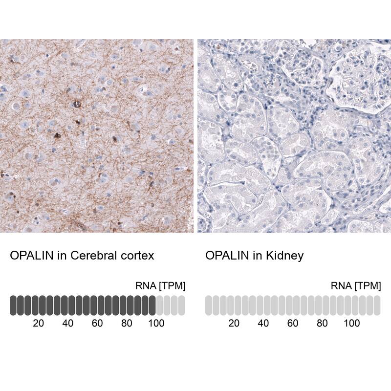 OPALIN Antibody (CL11142) - Azide and BSA Free Immunohistochemistry-Paraffin: OPALIN Antibody [NBP3-44178]