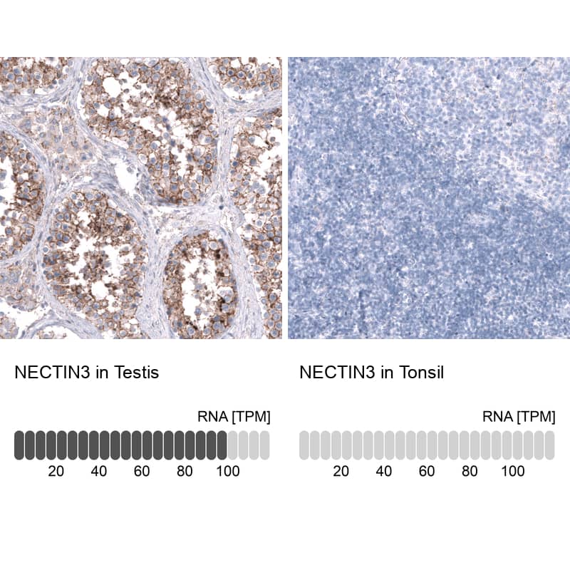 Nectin-3/PVRL3 Antibody (CL15364) - Azide and BSA Free Immunohistochemistry-Paraffin: Nectin-3/PVRL3 Antibody [NBP3-44180]