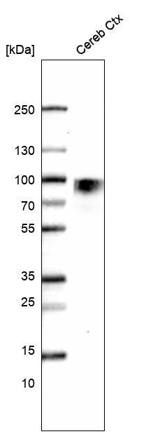Nectin-3/PVRL3 Antibody (CL15364) - Azide and BSA Free Western Blot: Nectin-3/PVRL3 Antibody [NBP3-44180]