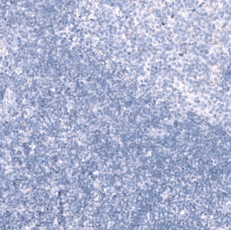 Nectin-3/PVRL3 Antibody (CL15364) - Azide and BSA Free Immunohistochemistry-Paraffin: Nectin-3/PVRL3 Antibody [NBP3-44180]