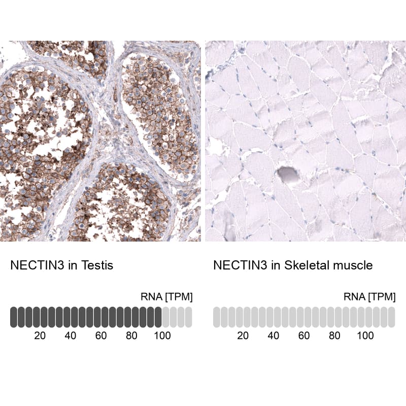 Nectin-3/PVRL3 Antibody (CL15366) - Azide and BSA Free Immunohistochemistry-Paraffin: Nectin-3/PVRL3 Antibody [NBP3-44181]