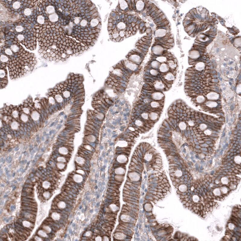 Nectin-3/PVRL3 Antibody (CL15366) - Azide and BSA Free Immunohistochemistry-Paraffin: Nectin-3/PVRL3 Antibody [NBP3-44181]