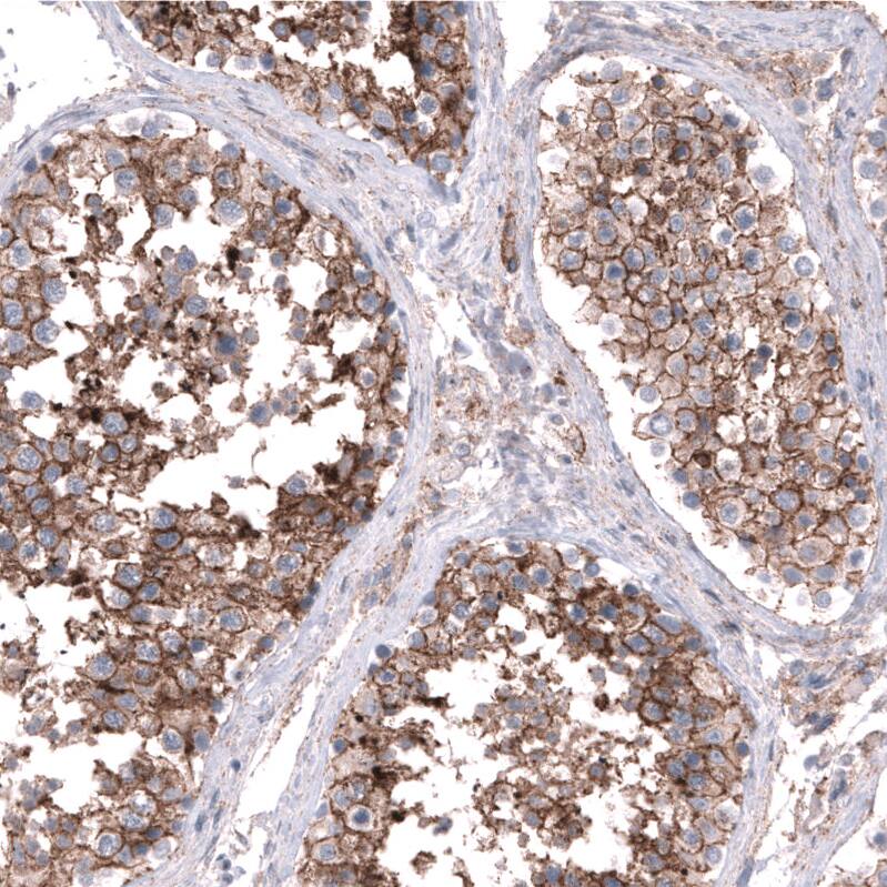 Nectin-3/PVRL3 Antibody (CL15366) - Azide and BSA Free Immunohistochemistry-Paraffin: Nectin-3/PVRL3 Antibody [NBP3-44181]